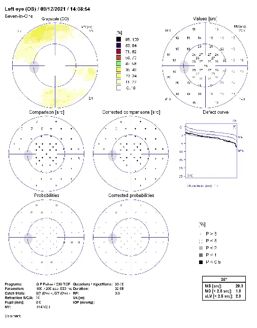 Axial length measurements