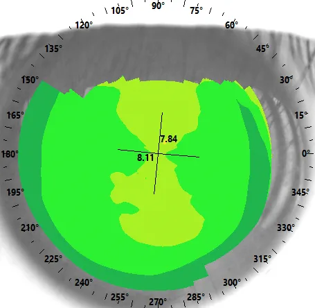 Fundus autofluorescence imaging