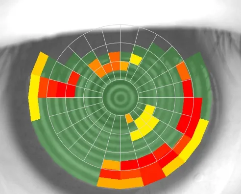 Tear film stability map